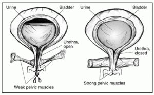 Stress incontinence is NOT a normal OR an inevitable part of growing older. 