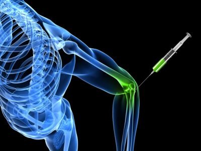 What is Prolotherapy?