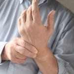 Arthritis
