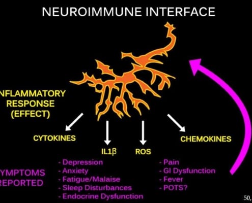 Inflammation_Central_sensitization_symptoms