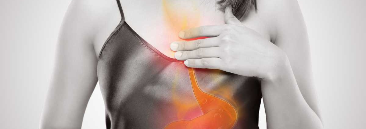treating acid reflux