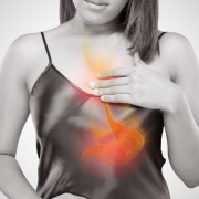 treating acid reflux